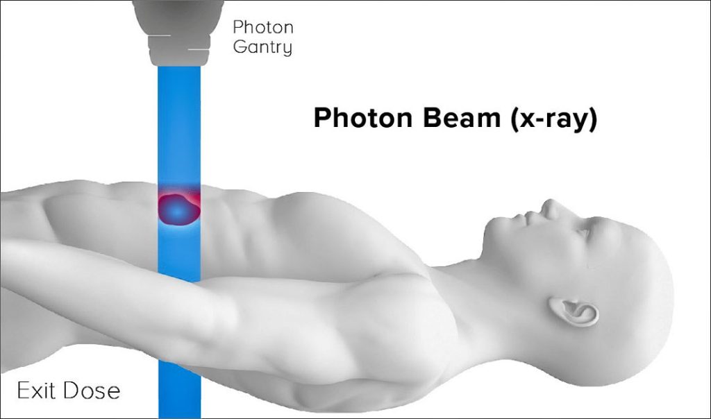 graphic of photon beam