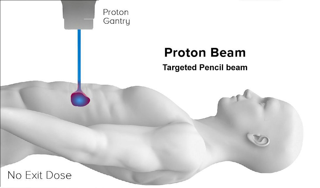 graphic of proton beam